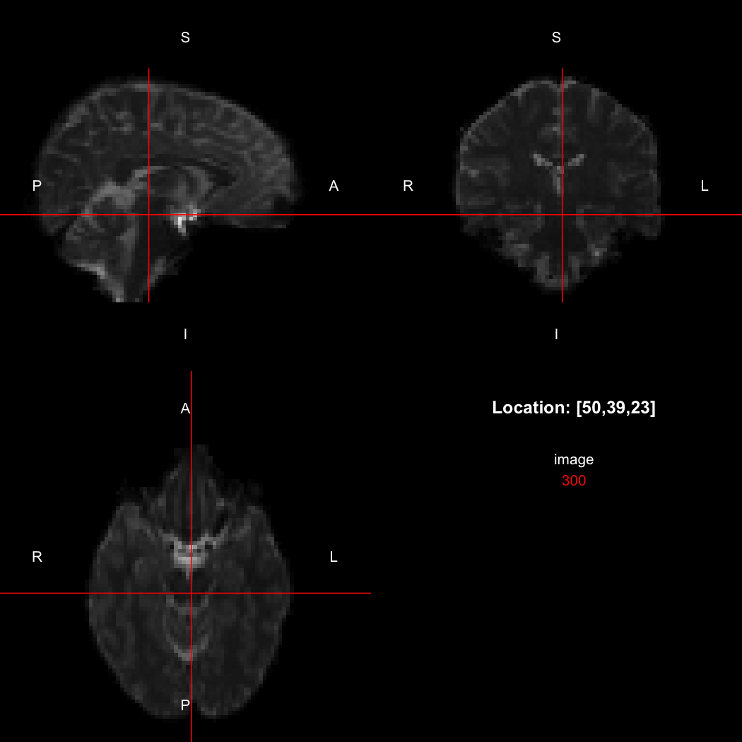 plot of chunk unnamed-chunk-12